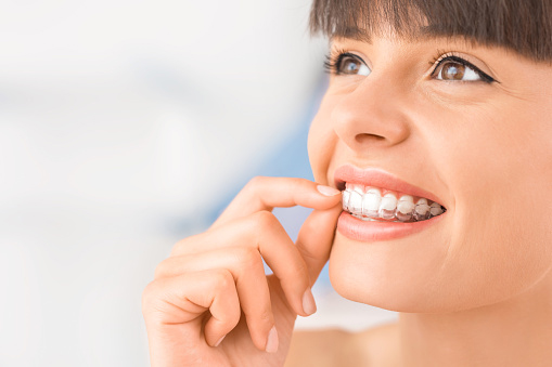 A woman smiling with clear aligners