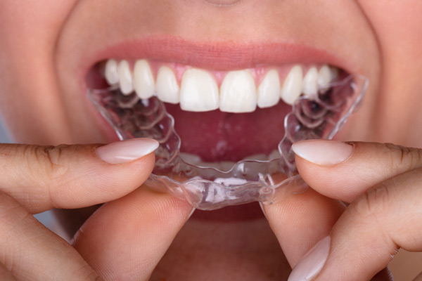 Close up of a patient putting clear aligners on her teeth at Raleigh Family Orthodontics in Raleigh, NC 
