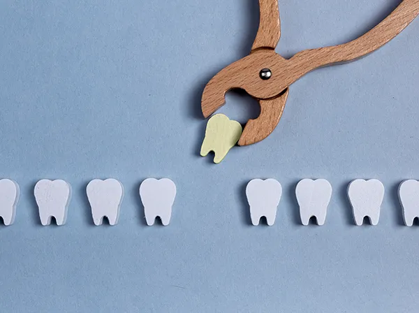 Row of wooden tooth shapes, one of which is being pulled out of the row by dental pliers at Raleigh Family Orthodontics in Raleigh, NC 